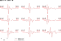 Thumbnail for version as of 17:50, 6 May 2021