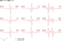 Thumbnail for version as of 17:50, 6 May 2021